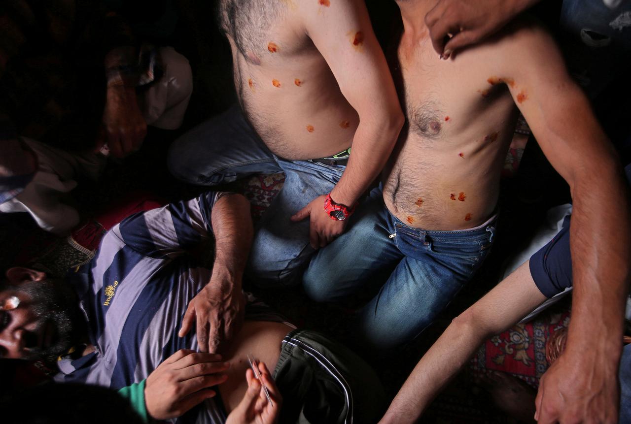 Men with pellet injuries are treated inside a house in a neighbourhood where there have been regular clashes with Indian security forces following restrictions after the government scrapped the special constitutional status for Kashmir, in Srinagar August 14, 2019. REUTERS/Danish Ismail